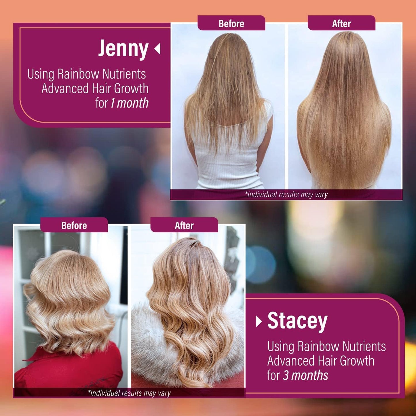 Hair Growth Vitamins for Women | Biotin 10,000Mcg, Collagen, Patented Optimsm®, Gomct®, Saw Palmetto | Naturally Regrow Stronger & Healthier Hair, Skin and Nails | Stops Hair Loss | 60 Day Supply