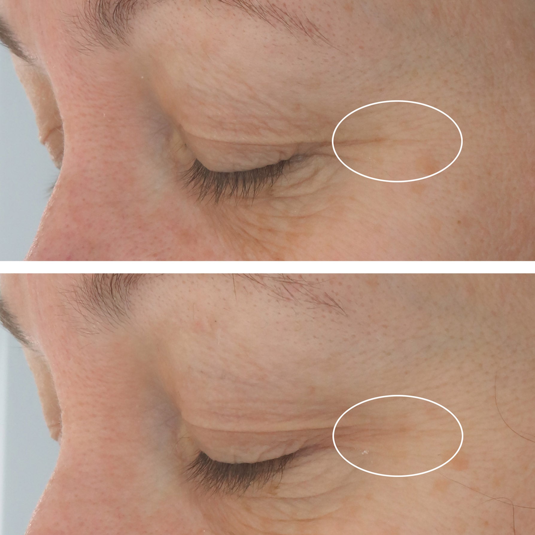 Strivectin Hyaluronic Tripeptide Gel-Cream for Eyes, 0.5 Oz, 2-Pack