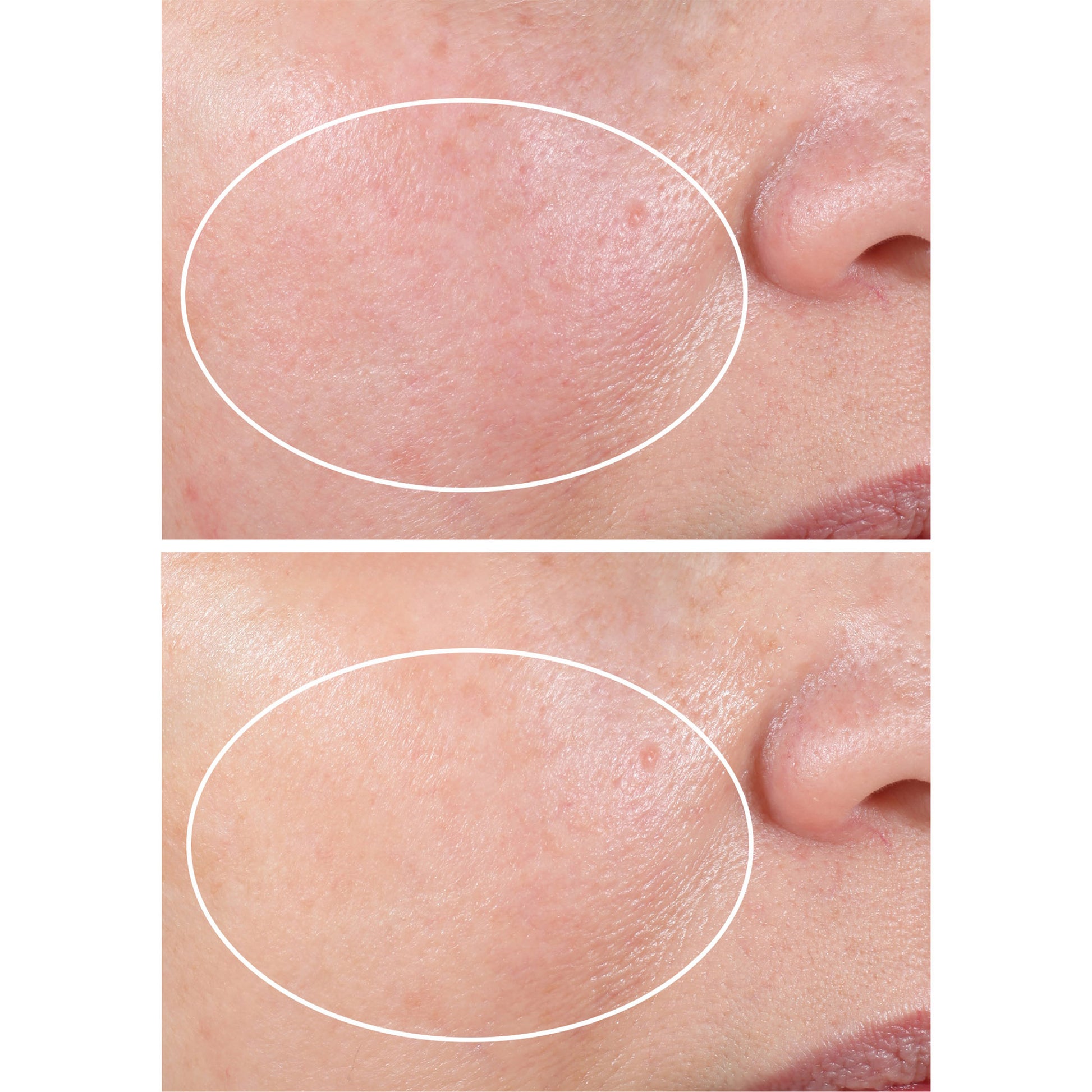 Strivectin Advanced Retinol Nightly Renewal Moisturizer, 1.0 Oz, 2-Pack